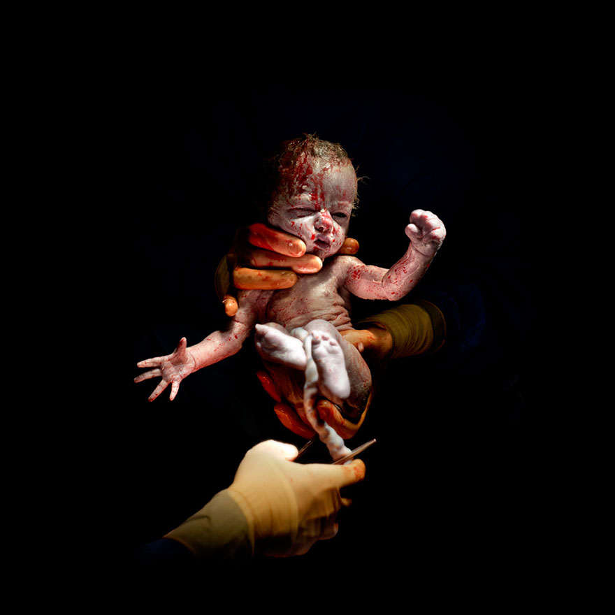 newborn-photos-c-section-infant-cesar-christian-berthelot-7