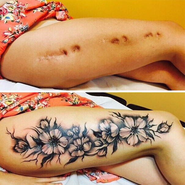 scars tattoos cover up 1 - 50 Incríveis tatuagens de encobrimento de cicatrizes