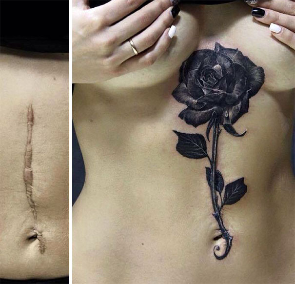 scars tattoos cover up 11 - 50 Incríveis tatuagens de encobrimento de cicatrizes