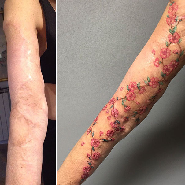 scars tattoos cover up 19 - 50 Incríveis tatuagens de encobrimento de cicatrizes