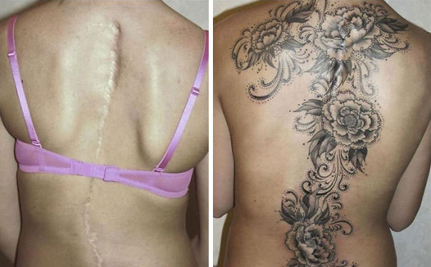 scars tattoos cover up 21 - 50 Incríveis tatuagens de encobrimento de cicatrizes