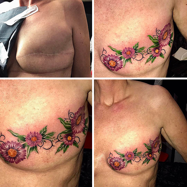 scars tattoos cover up 22 - 50 Incríveis tatuagens de encobrimento de cicatrizes