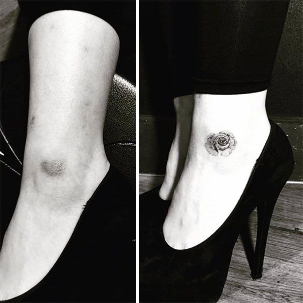 scars tattoos cover up 24 - 50 Incríveis tatuagens de encobrimento de cicatrizes