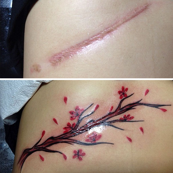 scars tattoos cover up 38 - 50 Incríveis tatuagens de encobrimento de cicatrizes