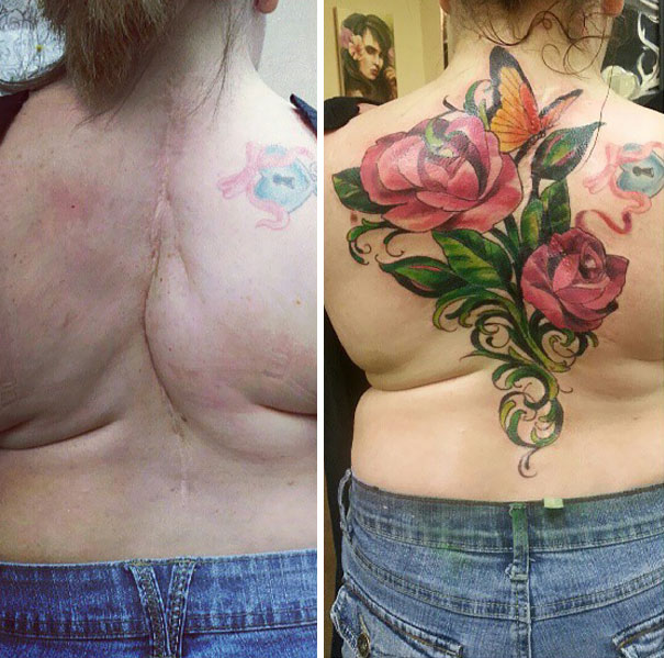 scars tattoos cover up 44 - 50 Incríveis tatuagens de encobrimento de cicatrizes