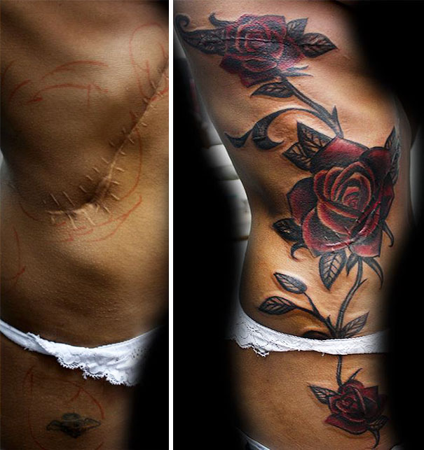 scars tattoos cover up 50 - 50 Incríveis tatuagens de encobrimento de cicatrizes