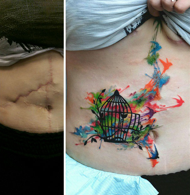 scars tattoos cover up 7 - 50 Incríveis tatuagens de encobrimento de cicatrizes