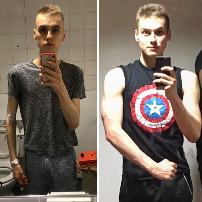 Tumblr Users Explain How Men Can Have Anorexia Too After Someone Begins Doubting One Mans Before-and-after Photos Httpsifttt2qzegqd - Creative As Many